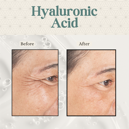 Hyaluronic Acid Complex Serum, 1oz