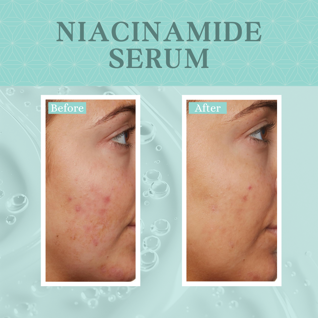 10% Niacinamide Serum