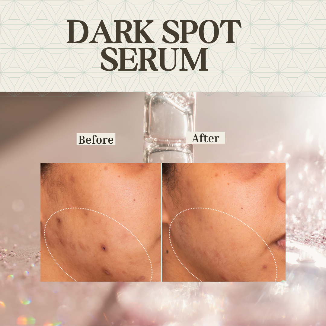 Dark Spot Serum for Normal Skin